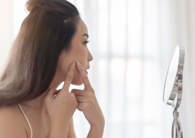 BÍ QUYẾT CHĂM DA ĐỂ NGĂN NGỪA MỤN QUAY TRỞ LẠI HIỆU QUẢ