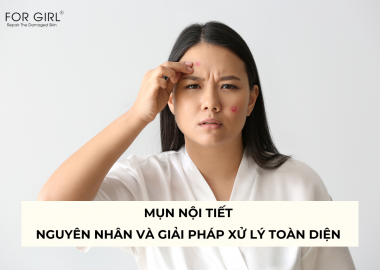 MỤN NỘI TIẾT - NGUYÊN NHÂN VÀ GIẢI PHÁP XỬ LÝ TOÀN DIỆN