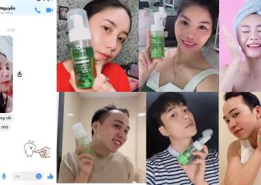 5 bước rửa mặt cho da mụn không phải ai cũng biết